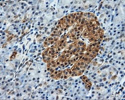 Monoclonal Mouse anti-Human BRAF / B-Raf Antibody (clone OTI1E2, IHC, IF, WB)