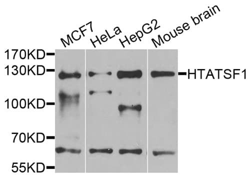 Polyclonal Rabbit anti-Human HTATSF1 / TAT-SF1 Antibody (IHC, WB)