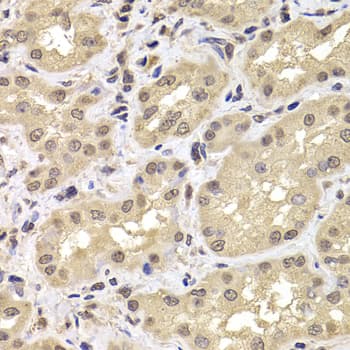 PSMD12 / Rpn5 Antibody