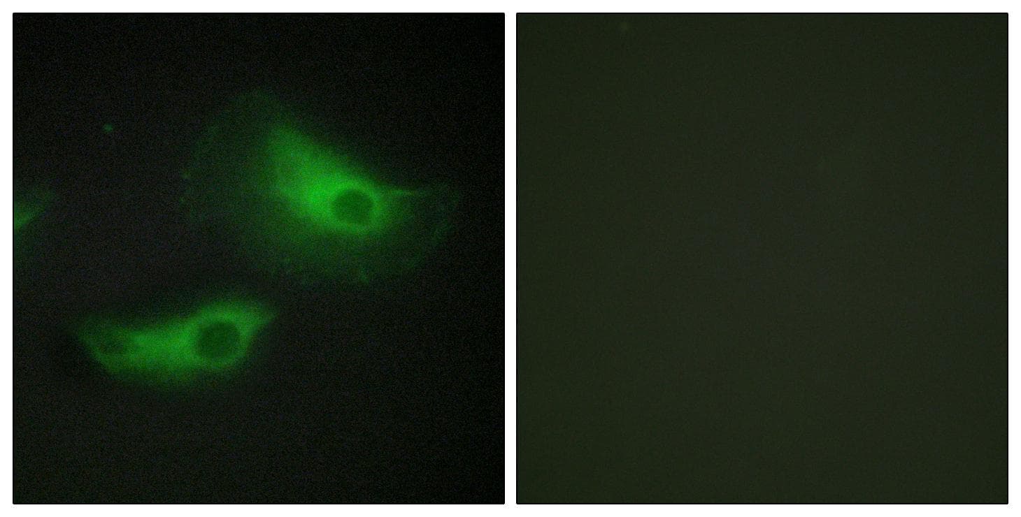 ADD2 Antibody