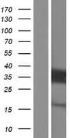 ACBD6 Protein (Over-Expression Lysate Myc-DDK (Flag))