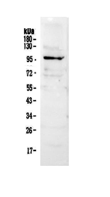 NFAT1 / NFATC2 Antibody