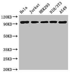 IHC-plus™ DDR2 Antibody