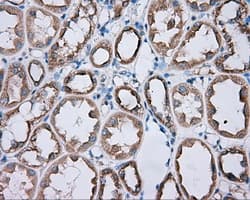 PRKAR2A Antibody (clone OTI1A7, Carrier-free)