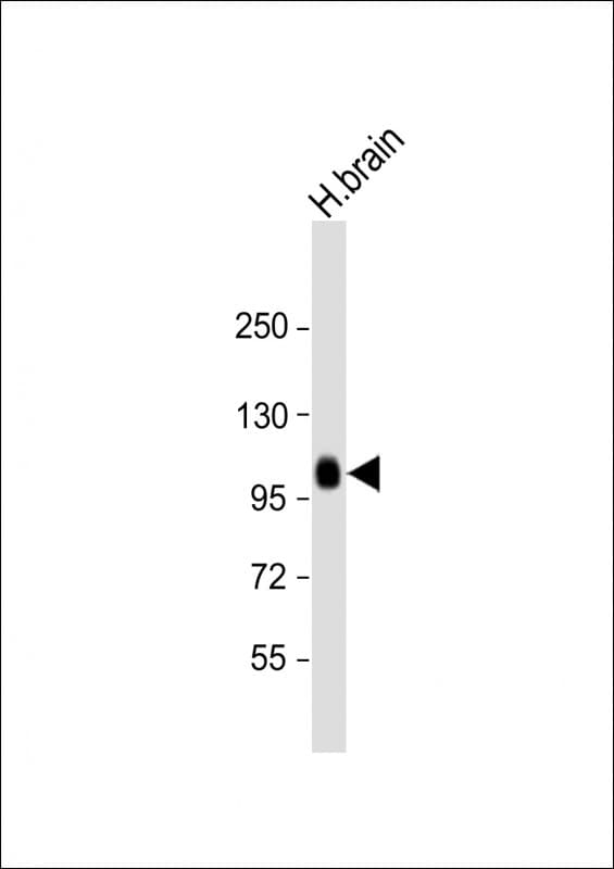 Polyclonal Rabbit anti-Human ADAMTS17 Antibody (N-Terminus, WB)