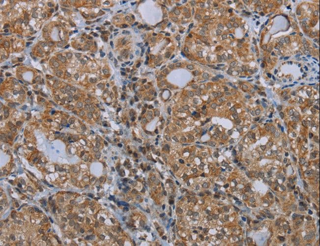 Polyclonal Rabbit anti-Human MARK1 / MARK Antibody (IHC)