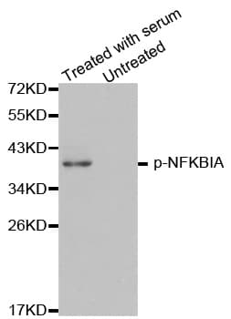 NFKBIA / IKB Alpha / IKBA Antibody (phospho-Tyr42)