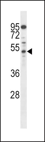 Polyclonal Rabbit anti-Human AP50 / AP2M1 Antibody (aa387-415, WB)
