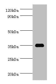Polyclonal Rabbit anti-Human SULT1C2 / Sulfotransferase 1C2 Antibody (aa1-120, WB)