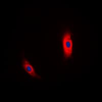 CSNK1A1 / CK1 Alpha Antibody (Internal)
