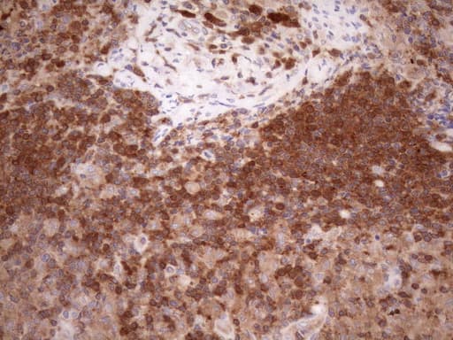 Monoclonal Mouse anti-Human POU2AF1 / BOB1 Antibody (clone OTI3A5, Carrier-free, IHC, WB)