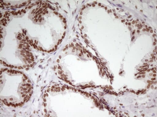 Monoclonal Mouse anti-Human SP110 Antibody (clone OTI4C1, aa232-521, IHC, WB)