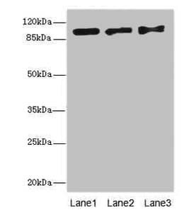 Polyclonal Rabbit anti-Human EXO1 Antibody