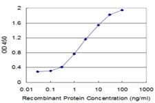 Monoclonal Mouse anti-Human ITGB6 / Integrin Beta 6 Antibody (clone 4C3, WB)