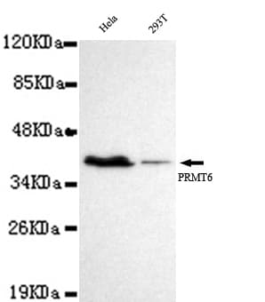 Monoclonal Mouse anti-Human PRMT6 Antibody (IHC, WB)