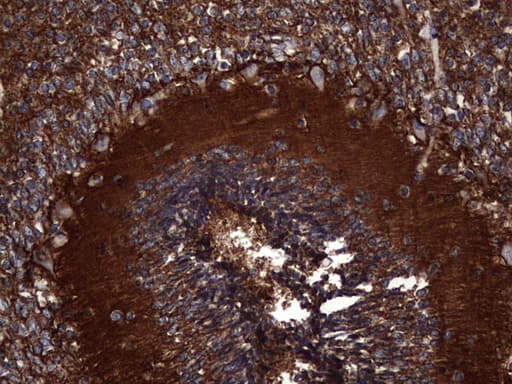 Monoclonal Mouse anti-Human NCAM / CD56 Antibody (clone OTI2A2, Carrier-free, aa20-718, IHC, WB)