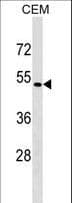 SSTR5 Antibody (aa311-339)