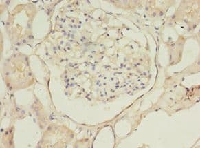 B4GAT1 / B3GNT1 Antibody (Biotin)
