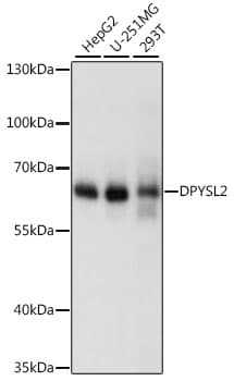 Polyclonal Rabbit anti-Human DPYSL2 / CRMP2 Antibody (WB)