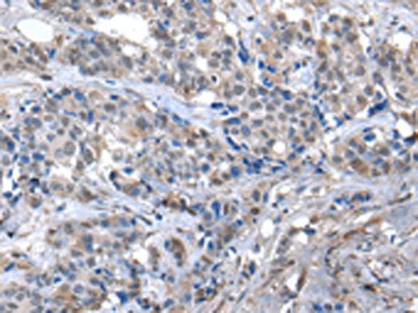 Polyclonal Rabbit anti-Human ZFP2 Antibody (IHC)