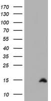 Cystatin SA / CST2 Antibody (clone OTI1H8)