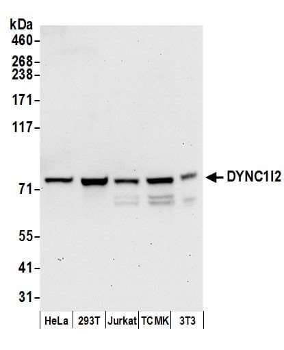 DYNC1I2 / IC2 Antibody (aa588-638)