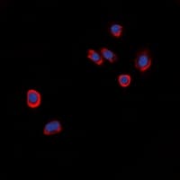 Polyclonal Rabbit anti-Human GPCR6 / GPR101 Antibody (C-Terminus, IHC, IF, WB)