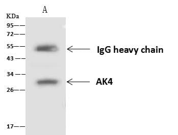 AK4 / Adenylate Kinase 4 Antibody