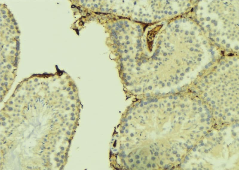 CHPF / CHSY2 Antibody