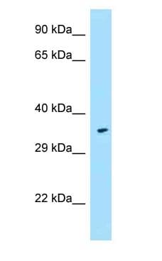 FPR1 / FPR Antibody (aa174-223, FITC)