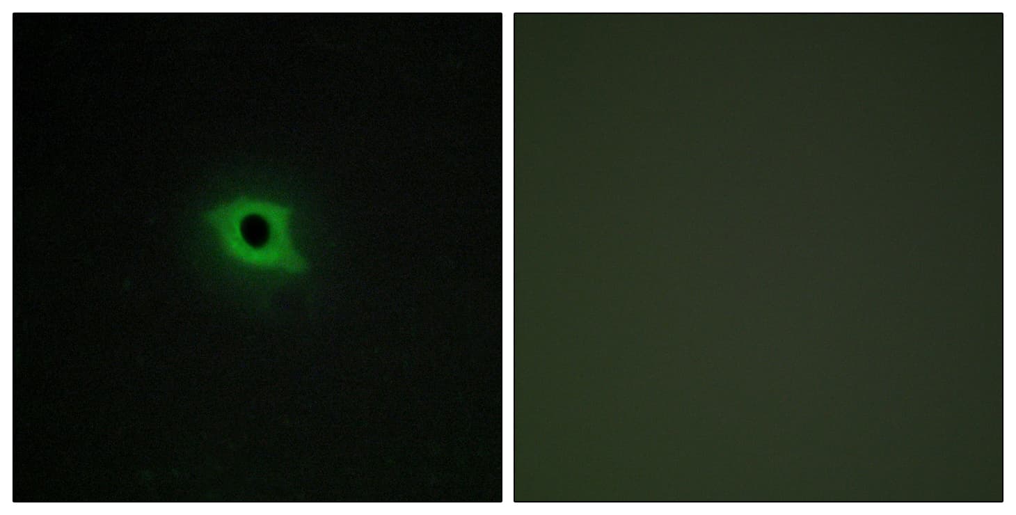 Polyclonal Rabbit anti-Human DGKK Antibody (aa1221-1270, IHC, IF)