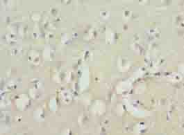Polyclonal Rabbit anti-Human ZNF177 / PIGX Antibody (IHC)