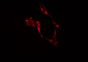 Polyclonal Rabbit anti-Human ITPKA Antibody (IF, WB)