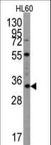 Polyclonal Rabbit anti-Human UBTD1 Antibody (aa180-212, IHC, WB)
