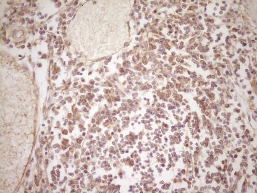 ERBB3 / HER3 Antibody (clone OTI3E10)