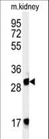 FBXL15 Antibody (aa252-280)