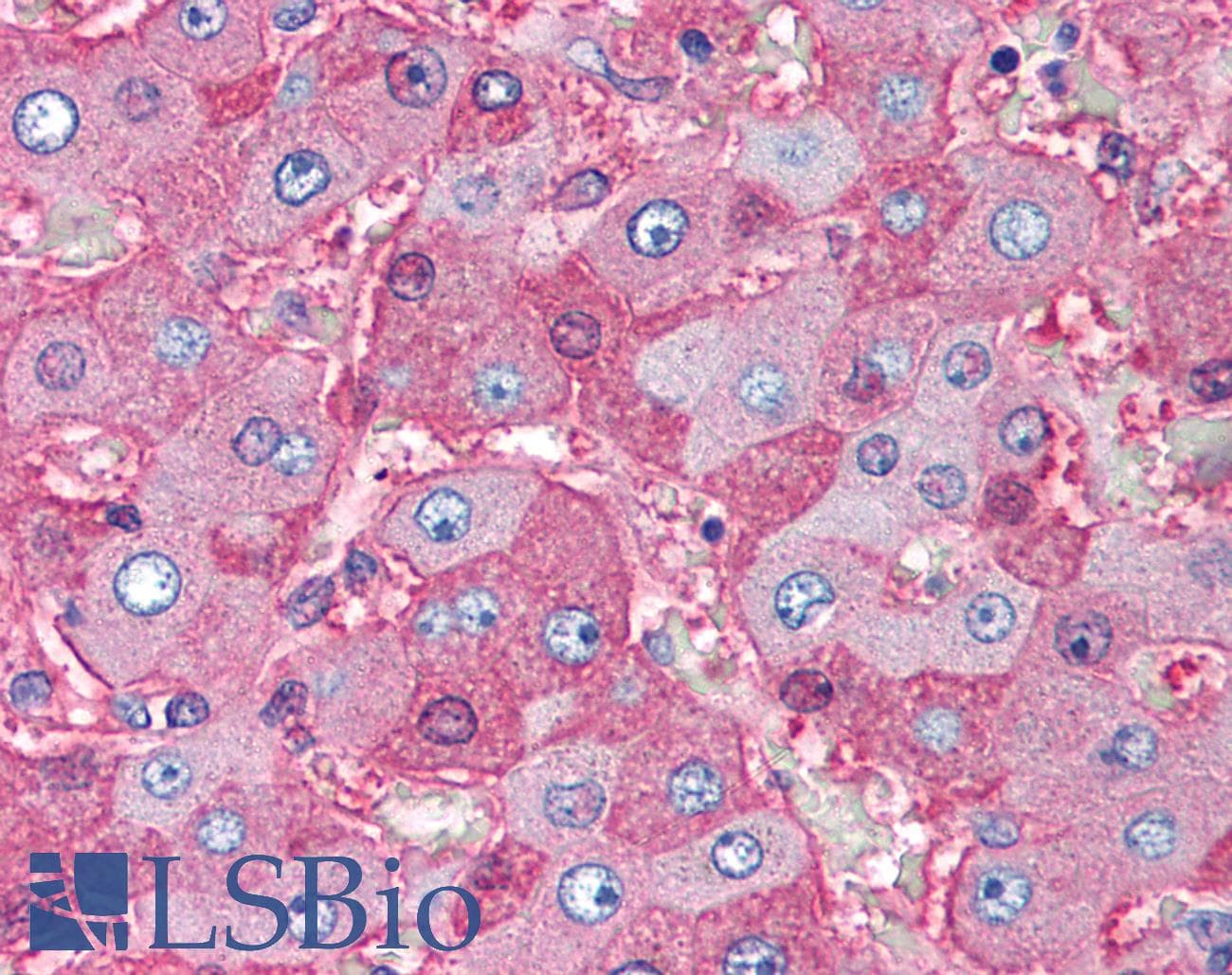 IHC-plus™ Monoclonal Mouse anti-Human ALB / Serum Albumin Antibody (clone AL-01, IHC, WB)