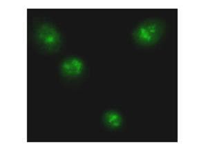 Polyclonal Rabbit anti-Human RELA / NFKB p65 Antibody (IHC, IF, WB)
