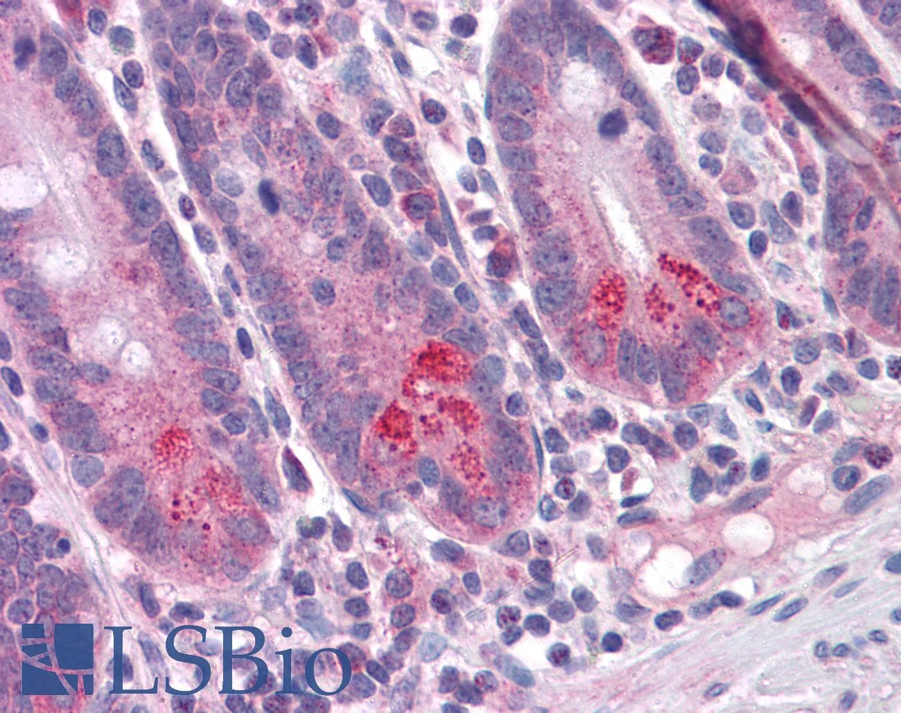 IHC-plus™ BRUCE / BIRC6 Antibody