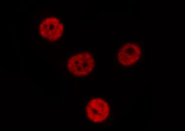 Polyclonal Rabbit anti-Human S100A16 Antibody (IHC, IF, WB)
