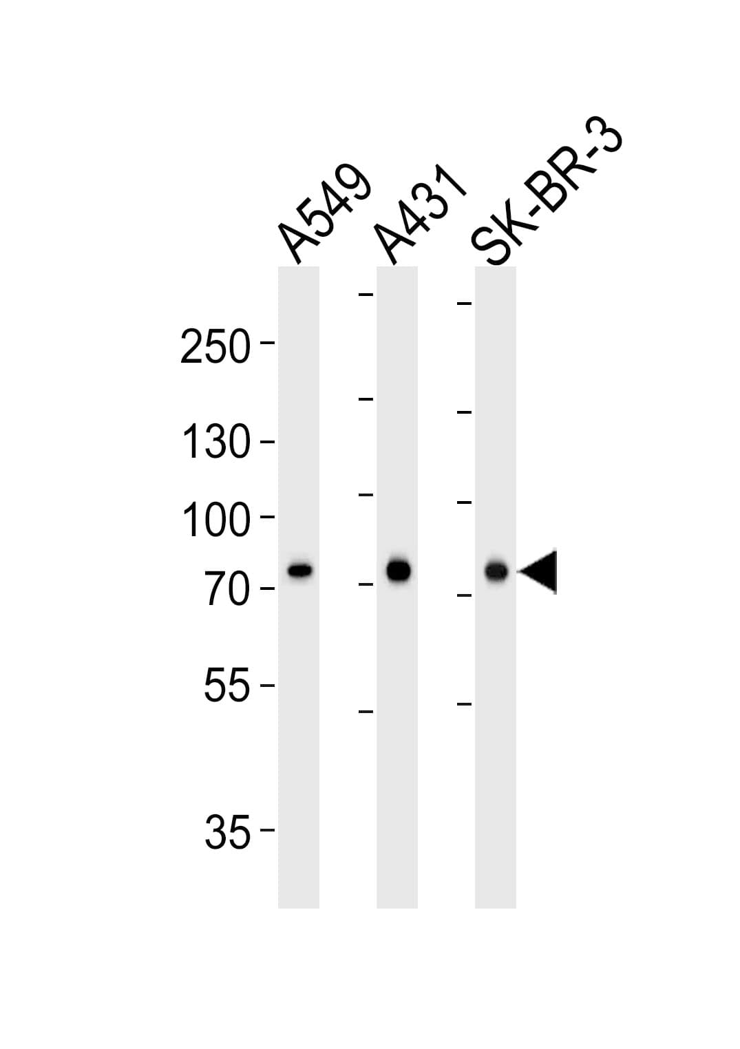 IHC-plus™ CAPN2 / Calpain 2 / M-Calpain Antibody (clone 1381CT669.7.66.71)