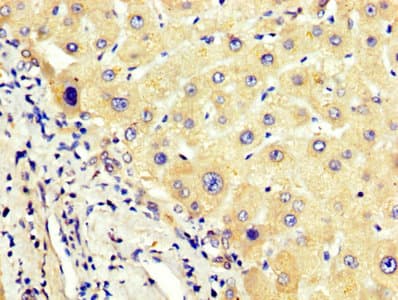 AGT / Angiotensinogen Antibody (aa44-427)