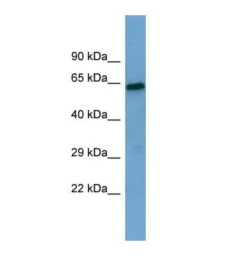 Polyclonal Rabbit anti-Human PA26 / SESN1 Antibody (aa208-257, WB)