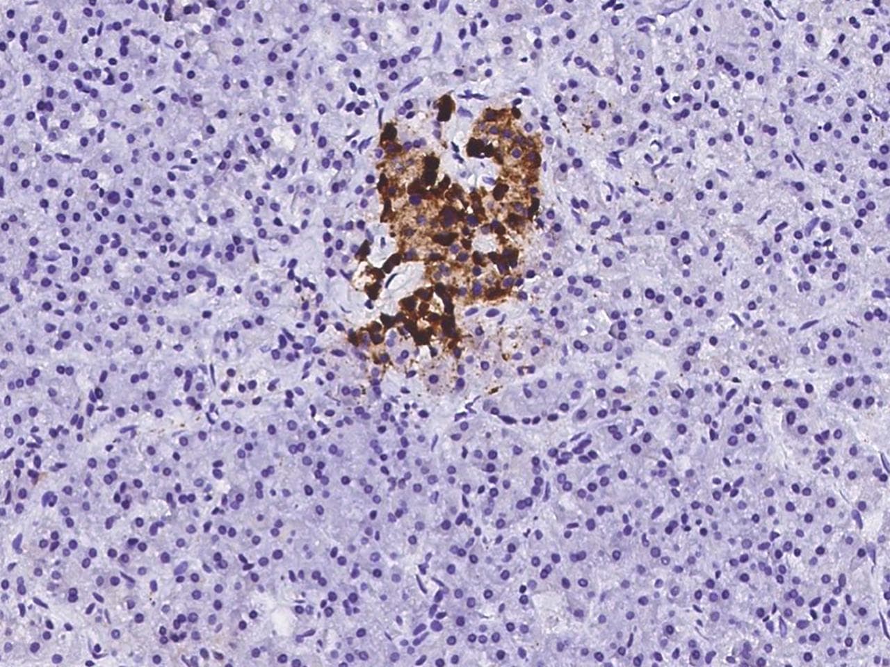 CHGA / Chromogranin A Antibody
