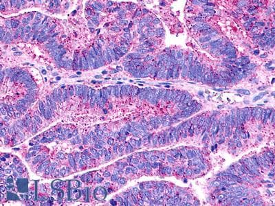 PathPlus™ GPCRW / GPR18 Antibody (Extracellular Domain)