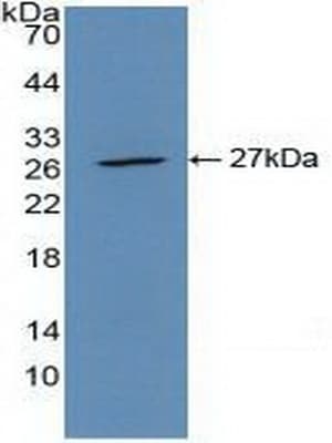 ACTA2 / Smooth Muscle Actin Antibody (aa167-377, APC)