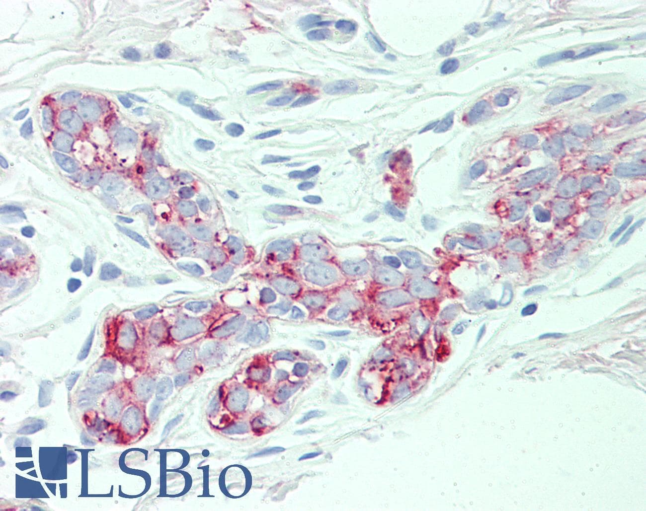 IHC-plus™ SLC4A2 / AE2 Antibody (N-Terminus)