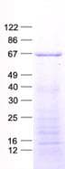 Human PIKFYVE / PIP5K Protein (Recombinant His, N-Terminal)