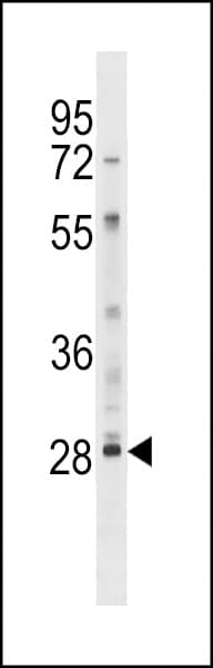 Polyclonal Rabbit anti-Human LY6G6F Antibody (aa56-84, WB)