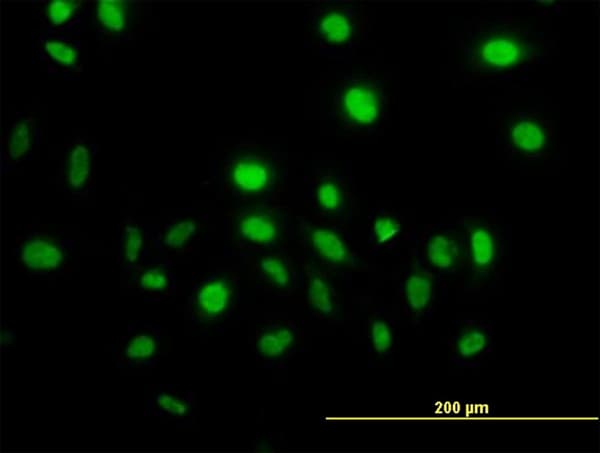 VAV1 / VAV Antibody (clone 9C1)